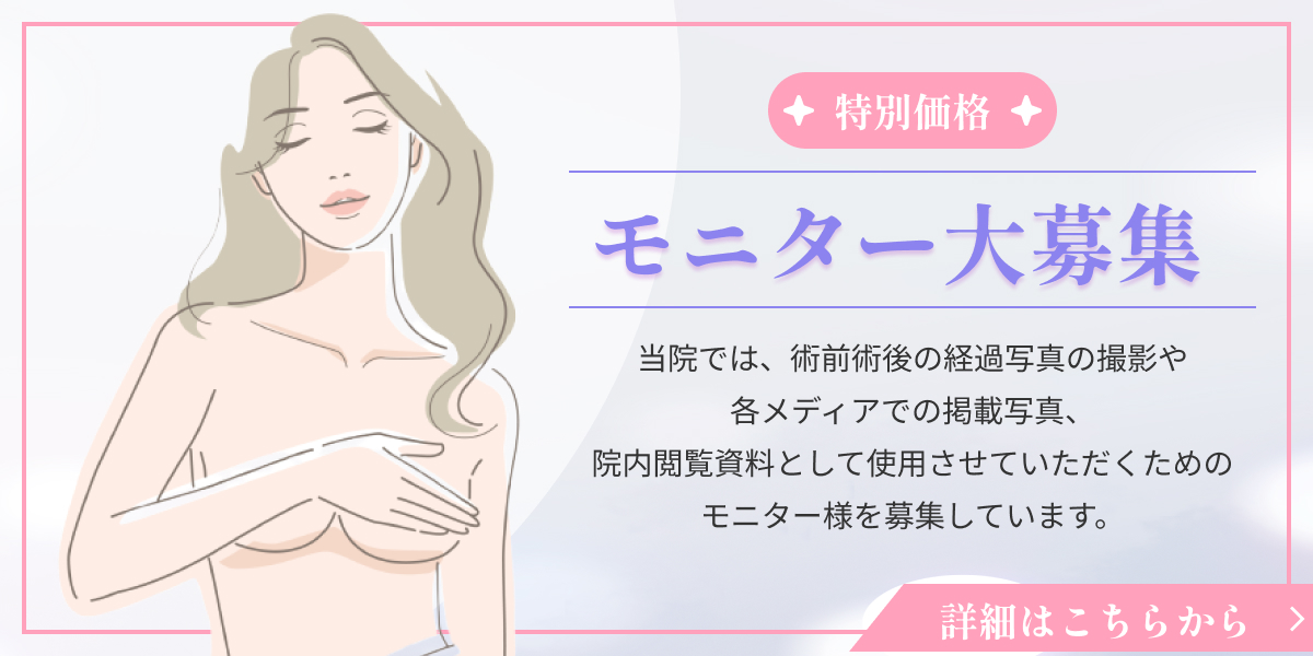 モニター大募集